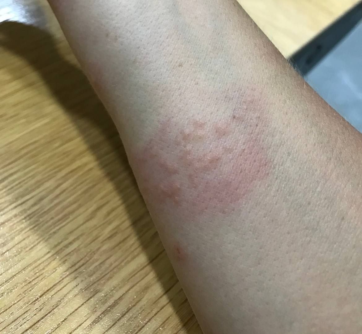 Что кусает в море?