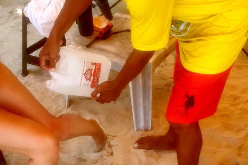 Ожоги от медуз на пляже Патонг