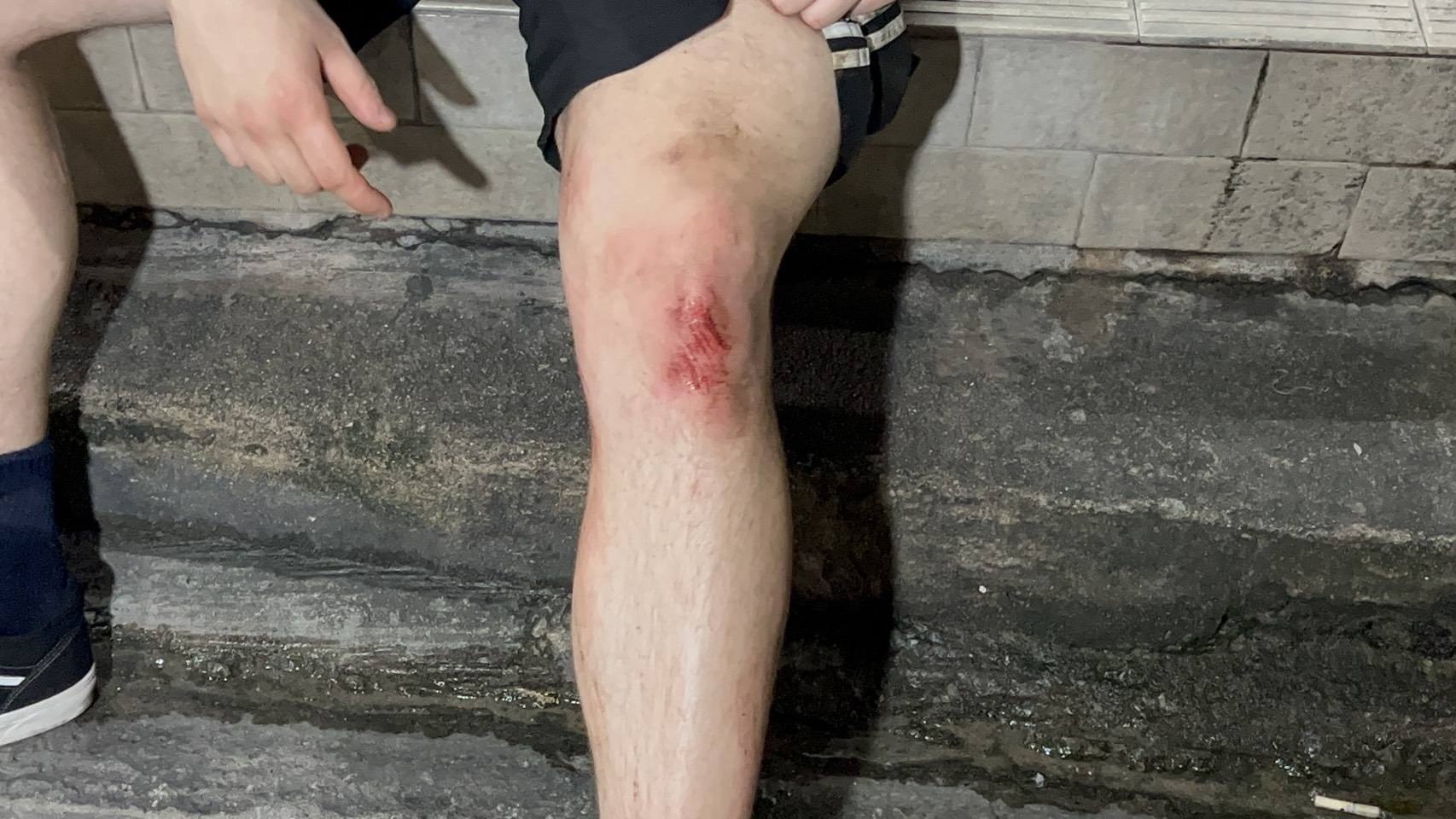 Инцидент с туристом в Паттайе