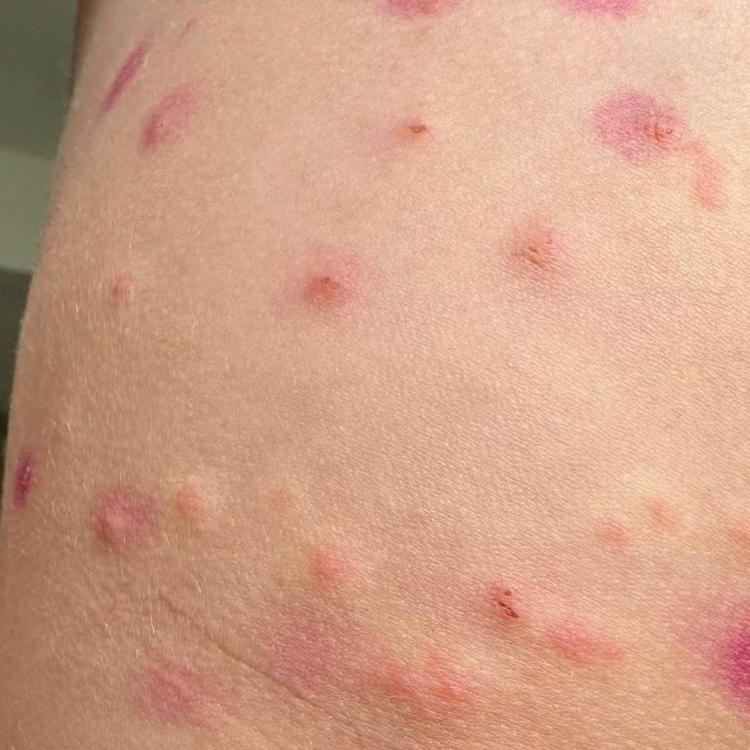 Планктон атакует туристов в Таиланде