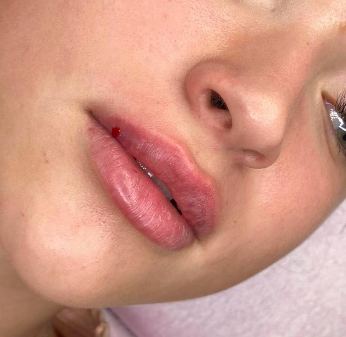 Услуги врача-косметолога