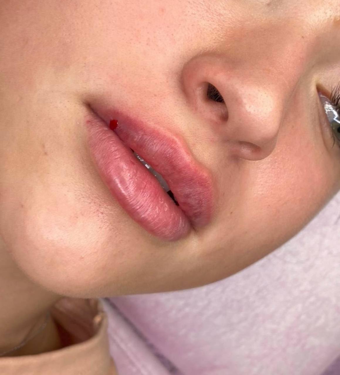 Услуги врача-косметолога