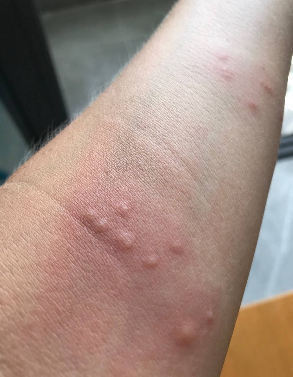 Что кусает в море?