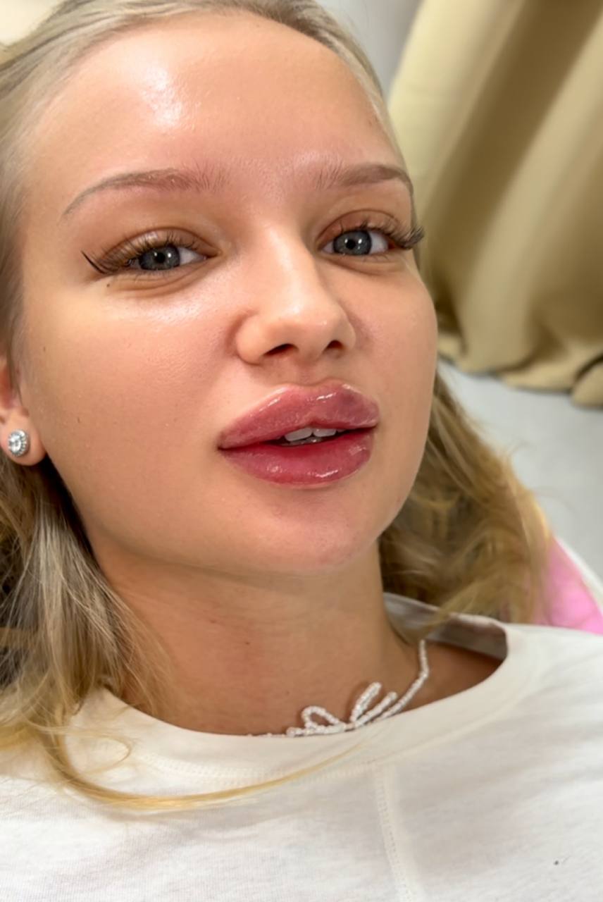 Услуги врача-косметолога