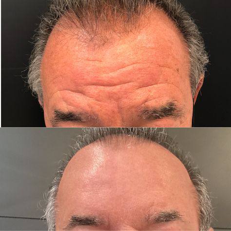 Услуги врача-косметолога