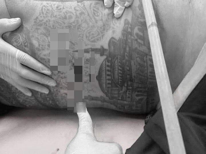 Стрельба в Патонге, погиб иностранец