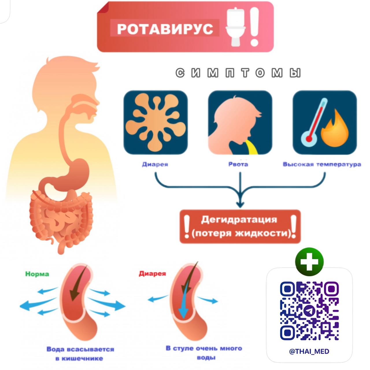 Описание и лечение ротавирусной инфекции